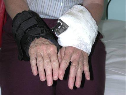Arthroscopic Surgery