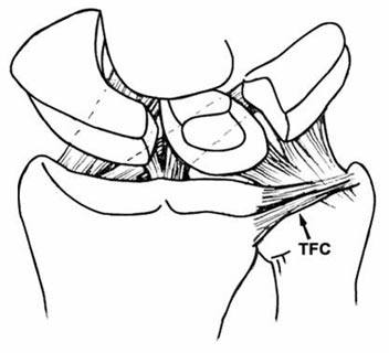 Other arthroscopic procedures