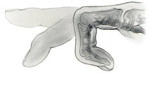 Percutaneous Soft Tissue Procedures