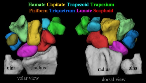 The 8 Carpal Bones: Hamate, Capitate, Trapezoid, Trapezium, Pisiform, Triquetrum, Lunate and the Scaphoid (in red)
